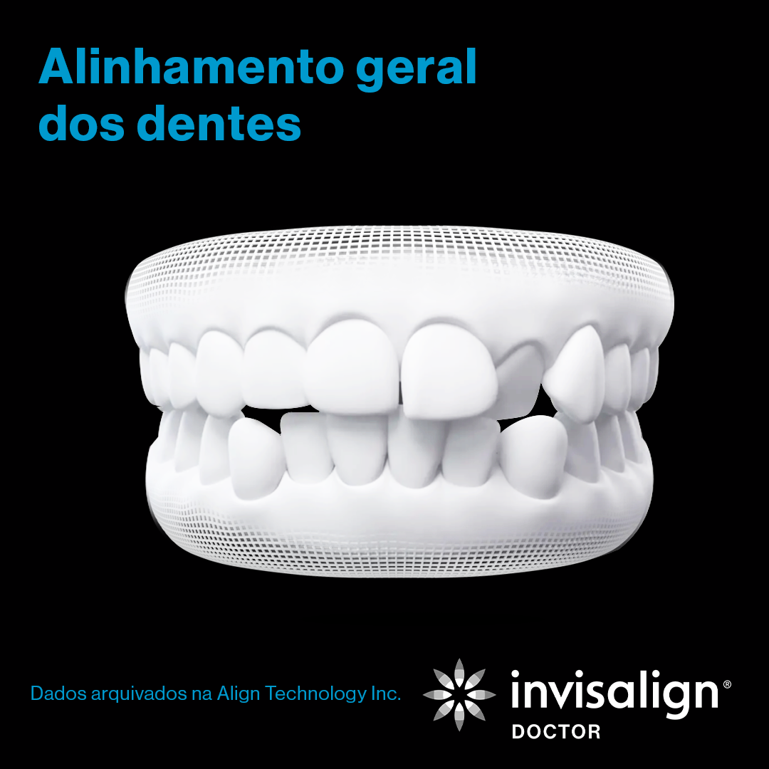 Invisalign_grade_nov_post01_gif_carrossel_POD_preto_1080x1080_8.png