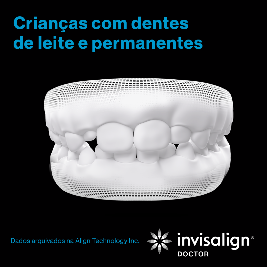 Invisalign_grade_nov_post01_gif_carrossel_POD_preto_1080x1080_9.png